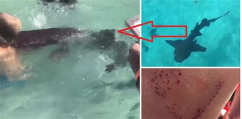 Nurse sharks, like many sharks, are curious creatures. . Nurse shark bahamas attack